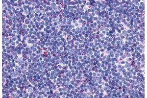 Anti-CCR10 antibody  ABIN1048387 IHC staining of human thymus. (CCR10 antibody  (Extracellular Domain))