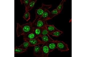Confocal Immunofluorescence of HeLa cells Ki67 Mouse Monoclonal Antibody (MKI67/2465). (Ki-67 antibody  (AA 2293-2478))