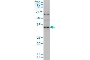 ZIC4 monoclonal antibody (M09), clone 3A2 Western Blot analysis of ZIC4 expression in Hela S3 NE . (ZIC4 antibody  (AA 249-319))