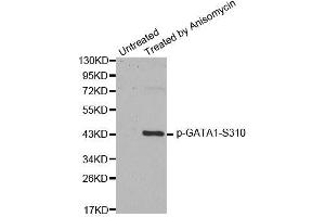 Western blot analysis of extracts from HT29 cells, using Phospho-GATA1-S310 antibody (ABIN2988025). (GATA1 antibody  (pSer310))
