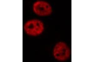 ABIN6277420 staining NIH-3T3 cells by IF/ICC.