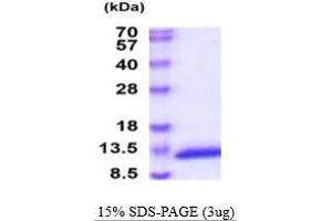 Calcium/calmodulin-Dependent Protein Kinase II Inhibitor 1 (CAMK2N1) (AA 1-78) protein (His tag)