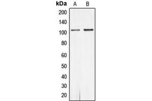 Western blot analysis of Androgen Receptor (pS650) expression in MCF7 (A), rat heart (B) whole cell lysates. (Androgen Receptor antibody  (pSer650))