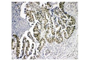 IHC analysis of KDM5B using anti-KDM5B antibody (ABIN4886648). (KDM5B antibody  (Middle Region))