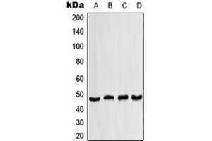Western blot analysis of CK1 delta expression in HepG2 (A), HeLa (B), Raw264. (CK1 delta (Center) antibody)