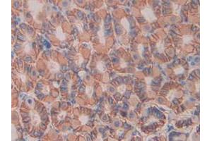 IHC-P analysis of Mouse Stomach Tissue, with DAB staining. (IL11RA antibody  (AA 194-329))