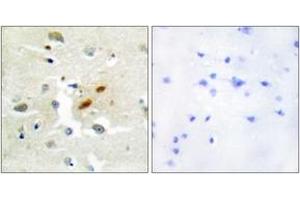 Immunohistochemistry (IHC) image for anti-REV3-Like, Polymerase (DNA Directed), Zeta, Catalytic Subunit (REV3L) (AA 231-280) antibody (ABIN2889337) (REV3L antibody  (AA 231-280))