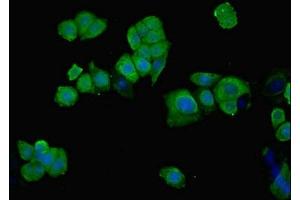 Immunofluorescent analysis of PC-3 cells using ABIN7149438 at dilution of 1:100 and Alexa Fluor 488-congugated AffiniPure Goat Anti-Rabbit IgG(H+L) (PHGDH antibody  (AA 2-251))