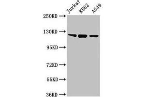 Western Blot Positive WB detected in: Jurkat whole cell lysate, K562 whole cell lysate, A549 whole cell lysate All lanes: Tlr7 antibody at 2 μg/mL Secondary Goat polyclonal to rabbit IgG at 1/50000 dilution Predicted band size: 122 kDa Observed band size: 122 kDa (TLR7 antibody  (AA 27-348))