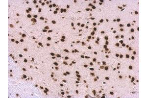 Immunohistochemistry (IHC) image for anti-Small Nuclear Ribonucleoprotein Polypeptide A (SNRPA) (C-Term) antibody (ABIN2855118)