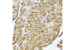 Immunohistochemistry (Paraffin-embedded Sections) (IHC (p)) image for anti-Cytochrome C, Somatic (CYCS) (AA 1-105) antibody (ABIN6139304)