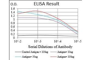 Black line: Control Antigen (100 ng), Purple line: Antigen(10 ng), Blue line: Antigen (50 ng), Red line: Antigen (100 ng), (CTNNBL1 antibody  (AA 390-557))