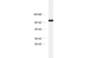 dilution: 1 : 1000, sample: crude synaptosomal fraction of rat brain (P2) (STXBP1 antibody)