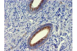 Image no. 3 for anti-Golgi Membrane Protein 1 (GOLM1) antibody (ABIN1498494) (GOLM1 antibody)