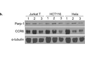 Western Blotting (WB) image for anti-Poly (ADP-Ribose) Polymerase 1 (PARP1) antibody (ABIN2854798)