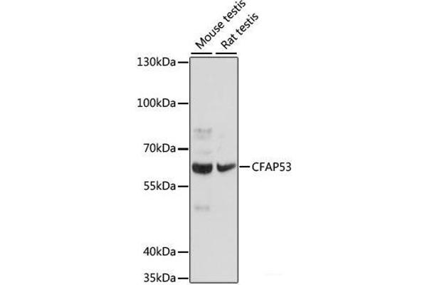 CCDC11 抗体