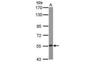Image no. 2 for anti-Aspartyl-tRNA Synthetase (DARS) (AA 304-501) antibody (ABIN1497768) (DARS antibody  (AA 304-501))