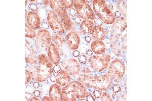 Immunohistochemistry of paraffin-embedded rat kidney using VASP antibody (ABIN6134453, ABIN6150064, ABIN6150065 and ABIN6218508) at dilution of 1:100 (40x lens). (VASP antibody  (AA 1-100))