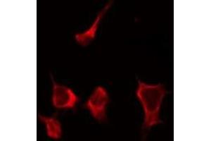 ABIN6268837 staining HepG2 by IF/ICC. (Galectin 9 antibody  (Internal Region))