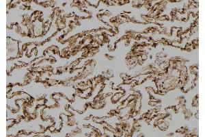 ABIN6273390 at 1/100 staining Human lung tissue by IHC-P. (SH3BP2 antibody  (Internal Region))