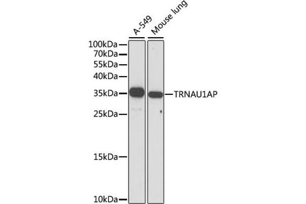 TRNAU1AP anticorps  (AA 1-287)