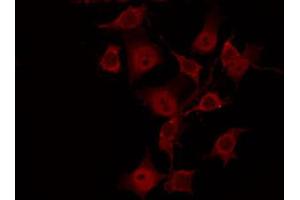 ABIN6269040 staining HeLa by IF/ICC. (SGK1 antibody  (C-Term))