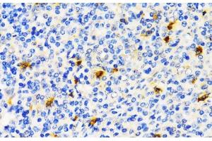 Immunohistochemistry of paraffin-embedded Human tonsil using TIM-3/HAVCR2 Polyclonal Antibody at dilution of 1:200 (40x lens). (TIM3 antibody)