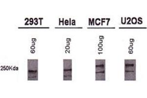 Western blot analysis of BRCA1 using BRCA1 monoclonal antibody, clone MU . (BRCA1 antibody  (AA 1314-1864))