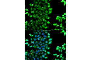 Immunofluorescence analysis of MCF7 cell using RNF7 antibody.
