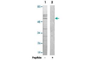Western blot analysis of extracts from 293 cells, using IP6K3 polyclonal antibody . (IP6K3 antibody)