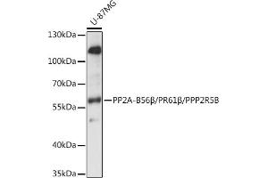 Western Blotting (WB) image for anti-Protein Phosphatase 2, Regulatory Subunit B', beta (PPP2R5B) (AA 1-130) antibody (ABIN7269689)