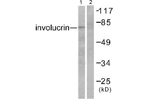 Western blot analysis of extracts from HuvEc cells, using Involucrin antibody (#C0236). (Involucrin antibody)