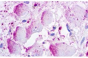Image no. 1 for anti-G Protein-Coupled Receptor 26 (GPR26) (Extracellular Domain) antibody (ABIN1048785) (GPR26 antibody  (Extracellular Domain))