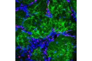 Immunofluorescence (IF) image for anti-Nerve Growth Factor Receptor (NGFR) antibody (ABIN350707)