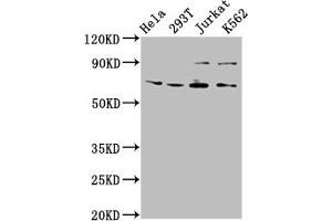Western Blot Positive WB detected in: Hela whole cell lysate, 293T whole cell lysate, Jurkat whole cell lysate, K562 whole cell lysate All lanes: ALG9 antibody at 6. (ALG9 antibody  (AA 434-618))