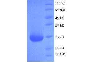SDS-PAGE (SDS) image for Fibroblast Growth Factor 23 (FGF23) (AA 25-251), (full length) protein (His tag) (ABIN7479357)