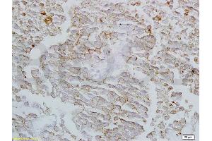 Formalin-fixed and paraffin embedded rat lung labeled with Anti-Claudin-4 Polyclonal Antibody, Unconjugated (ABIN680743) at 1:200 followed by conjugation to the secondary antibody and DAB staining