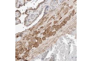 Immunohistochemical staining of human placenta with FLJ43582 polyclonal antibody  shows strong membranous and cytoplasmic positivity in decidual cells at 1:20-1:50 dilution. (C8ORF86 antibody)