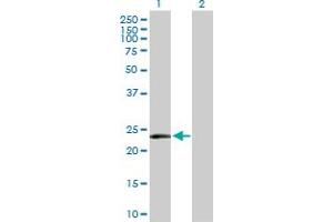 Western Blot analysis of MSRA expression in transfected 293T cell line by MSRA MaxPab polyclonal antibody. (MSRA antibody  (AA 1-235))