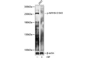 Western blot analysis of extracts of 293T cells, using Phospho-MYH9-S1943 antibody (ABIN7268744) at 1:2000 dilution. (Myosin 9 antibody  (pSer1943))