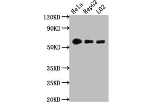 Western Blot Positive WB detected in: Hela whole cell lysate, HepG2 whole cell lysate, L02 whole cell lysate All lanes: CYP1A2 antibody at 1:1000 Secondary Goat polyclonal to rabbit IgG at 1/50000 dilution Predicted band size: 59 kDa Observed band size: 59 kDa (Recombinant CYP1A2 antibody)
