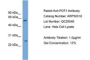 WB Suggested Anti-POT1  Antibody Titration: 0. (POT1 antibody  (Middle Region))