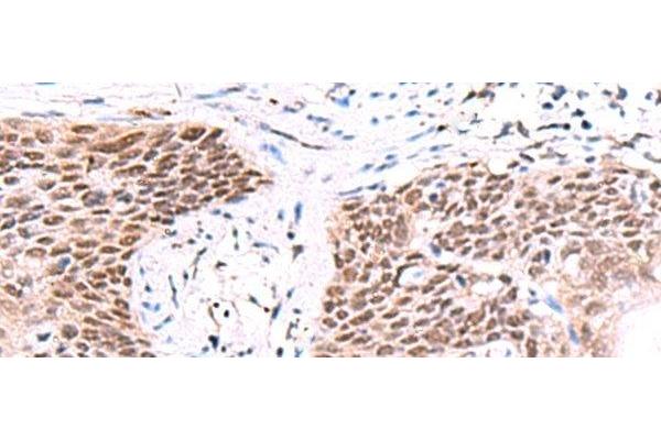 IRF2BP1 antibody