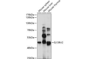 Western blot analysis of extracts of various cell lines, using IL13R antibody (043) at 1:1000 dilution. (IL13RA2 antibody  (AA 27-343))
