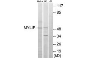 Western blot analysis of extracts from HeLa/Jurkat cells, using MYLIP Antibody. (MYLIP antibody  (AA 161-210))