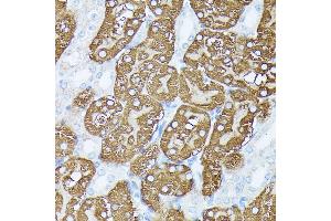 Immunohistochemistry of paraffin-embedded mouse kidney using PLS1 antibody (ABIN7269391) at dilution of 1:100 (40x lens). (PLS1 antibody  (AA 1-110))