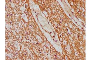 IHC image of ABIN7142186 diluted at 1:600 and staining in paraffin-embedded human brain tissue performed on a Leica BondTM system. (CYP7B1 antibody  (AA 312-430))