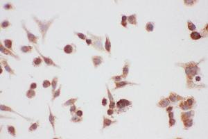 Immunohistochemistry (IHC) image for anti-Heat Shock Protein 90kDa alpha (Cytosolic), Class A Member 1 (HSP90AA1) (AA 2-365) antibody (ABIN3043847)