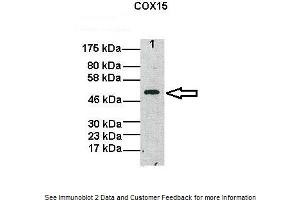 Lanes:   Lane1: 20ug human fibroblast mitochondria  Primary Antibody Dilution:   1:1000  Secondary Antibody:   Anti-Rabbit HRP  Secondary Antibody Dilution:   1:5000  Gene Name:   COX15  Submitted by:   Oleh Khalimonchuk, University of Nebraska-Lincoln (COX15 antibody  (N-Term))