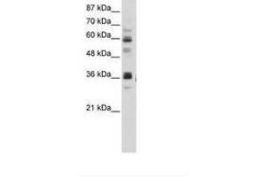 Image no. 2 for anti-RNA Pseudouridylate Synthase Domain Containing 2 (RPUSD2) (AA 201-250) antibody (ABIN202743)